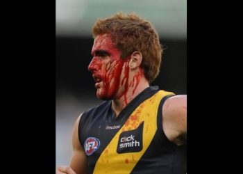 AFL biggest hits- Here comes the boom