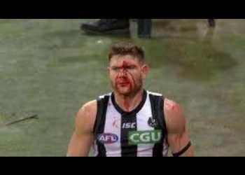 *NEW* AFL | Best Bumps, Tackles and Injuries of the first half of the 2020 season!!