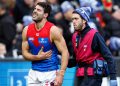 Footy Fix: The Dees are as busted as Petracca’s ribs